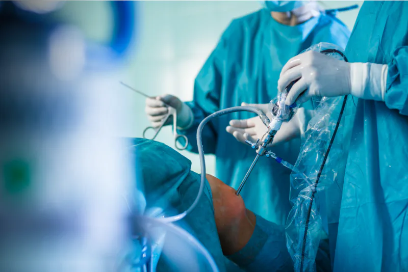 Laparoscopic bariatric surgery in an operating theatre