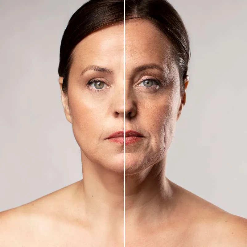 Facelift surgery consultation