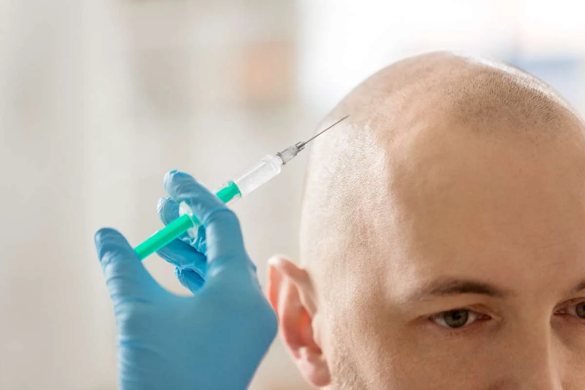 Hair transplant procedure being performed