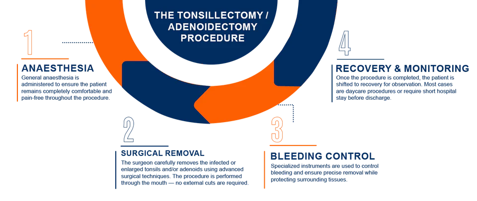 Tonsils and adenoids treatment procedure
