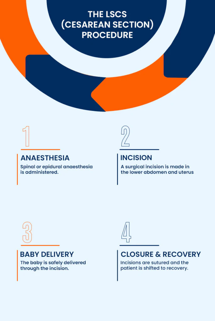 Caesarean section delivery procedure overview