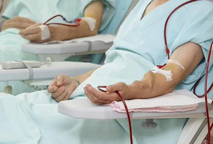 Illustration explaining kidney dialysis