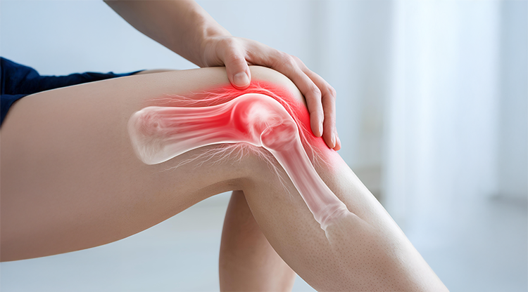 Knee Replacement Surgery