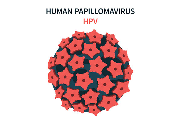  HPV Infection