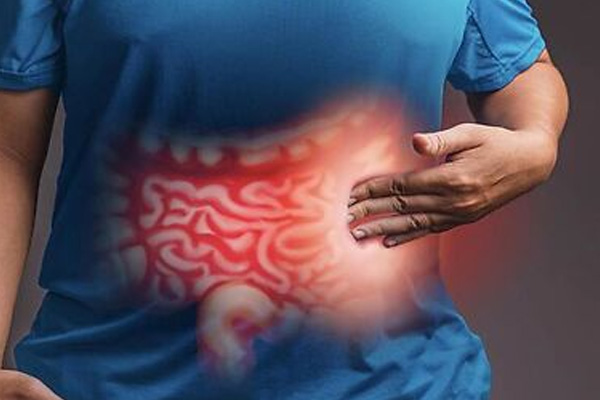 Inflammatory Bowel Disease