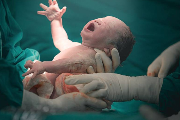 Pregnancy and Childbirth