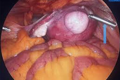 Anaesthesia-Related Effects