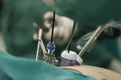 Injury to Surrounding Organs