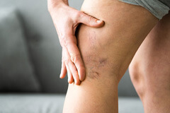 Mild Pain or Bruising